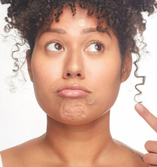 Patchology - Not A Spot Hydrocolloid Dots